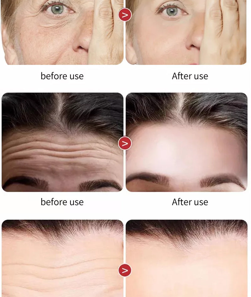 HOT SELLING....Due Care Instant Anti-Aging Wrinkle remover Cream with 2.5% Retinol Moisturizer , Hyaluronic acid and Vitamin E 50Ml